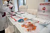 Au CHEM d'Esch-sur-Alzette, des mesures prises en 2016 ont permis de réduire les prescriptions d'antibiotiques de 10 %.