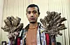 Abul Bajandar, un père de famille de 26 ans originaire du district de Khulna (sud), subit des examens en vue de l'opération visant à couper les excroissances pesant au moins cinq kilogrammes qui lui couvrent les mains et les pieds.