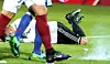 D'après l'enquête, au moins trois pétards ont pu blesser Anthony Lopes.